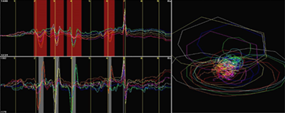 Alternating Current Field Measurement